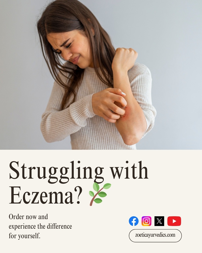 🌿 Say Goodbye to Skin Irritation with the Healing Power of Ayurveda!